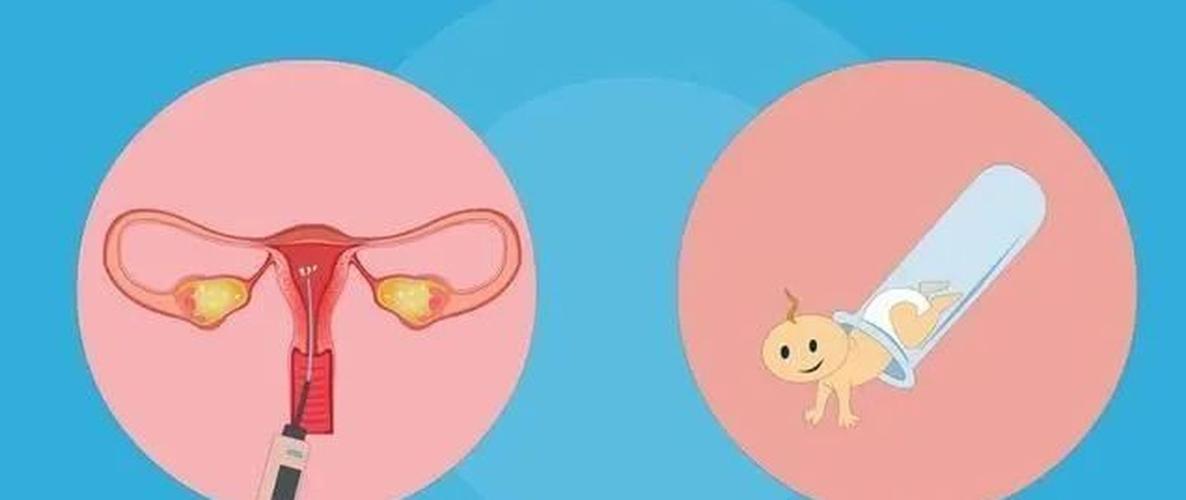 借卵生子到哪里做【借卵生子：选择何处才是最佳之地】